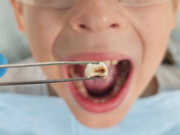 Best Mobile Emergency Dentist in Inverness, IL