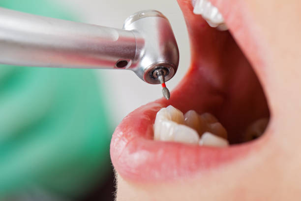 Best Broken or Cracked Tooth Emergency Dentist in Inverness, IL